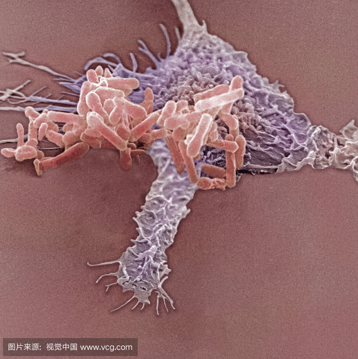 假单胞菌被巨噬细胞吸收。 SEM。