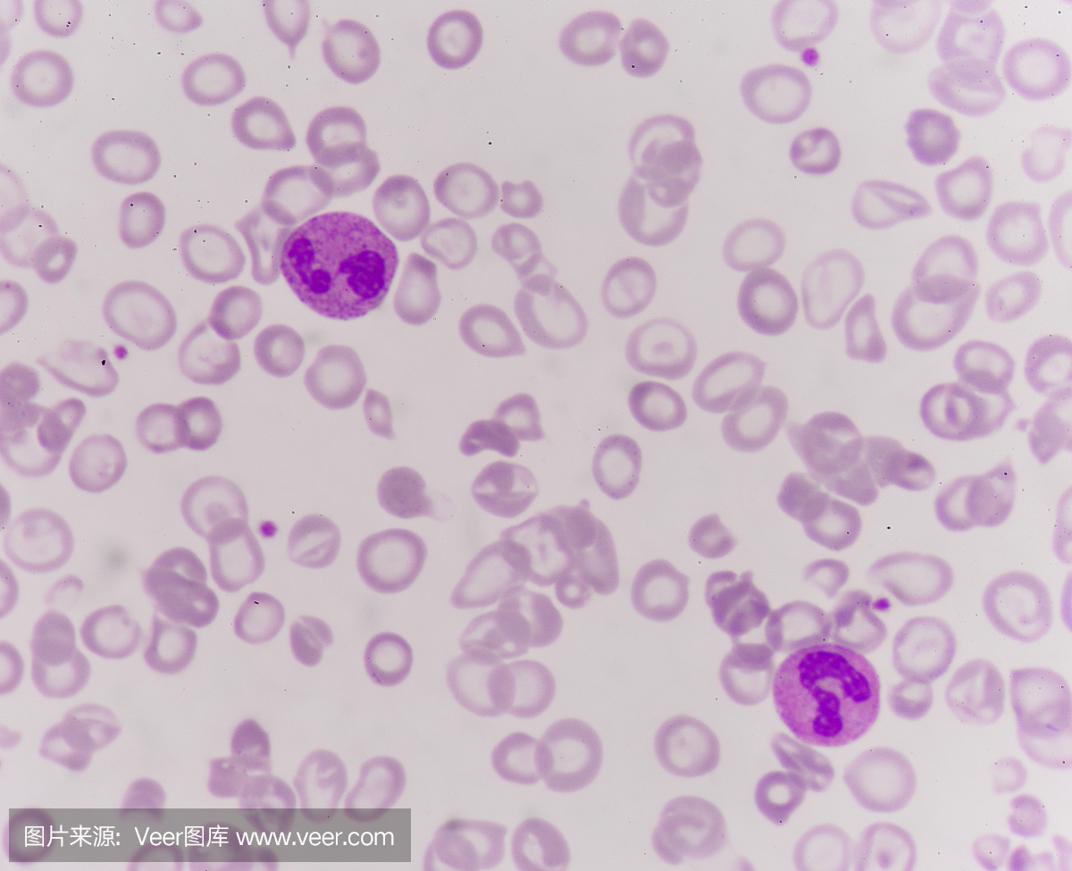 外周血涂片中的中性粒细胞(白细胞),Wr