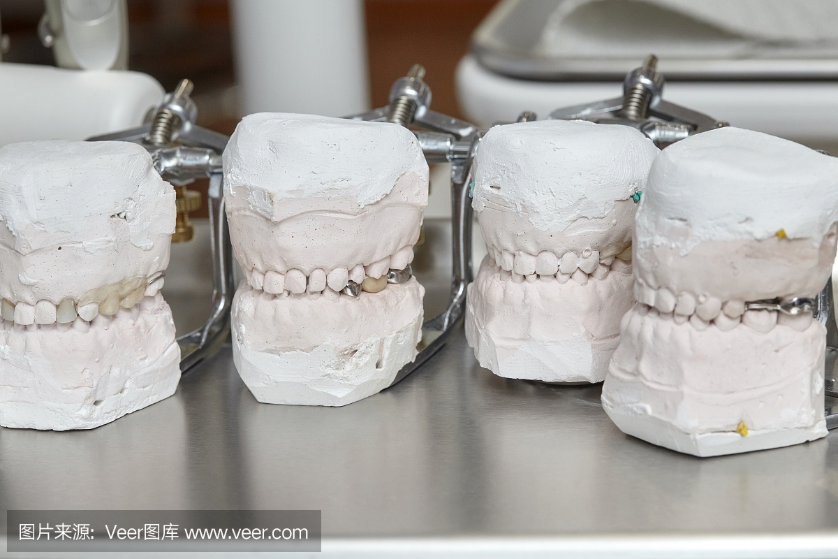 灰色牙科假牙牙齿模具,粘土人牙胶模型