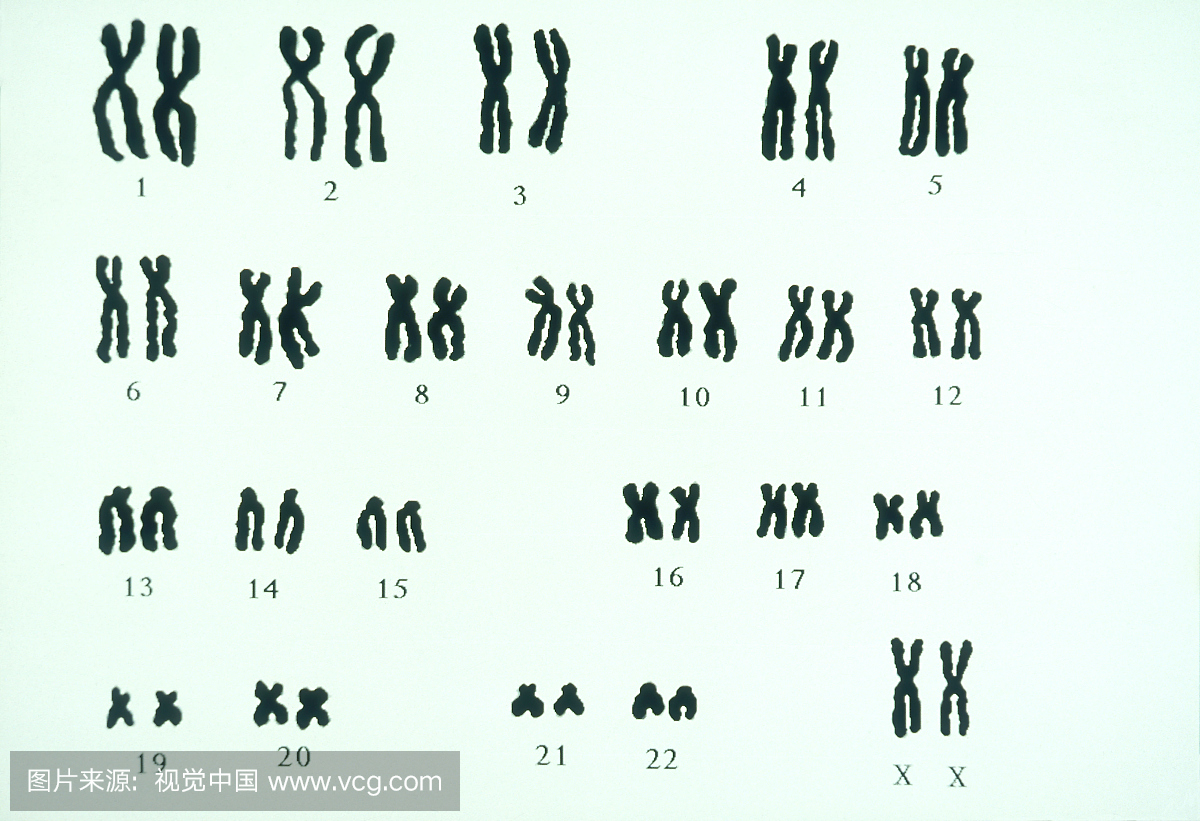 单染色体和复制染色体结构的图解插画图片素材_ID:428427927-Veer图库