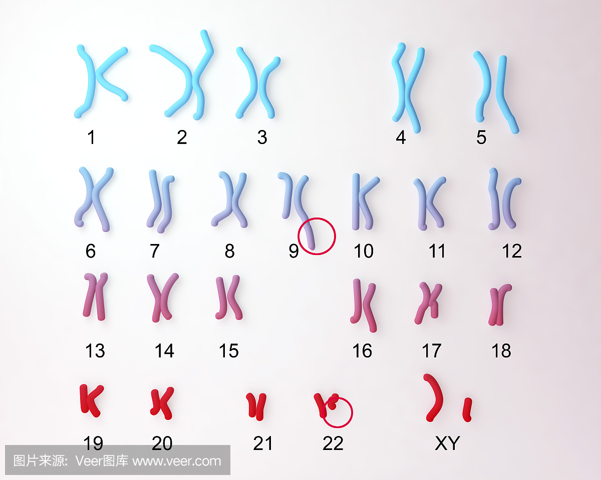 费城染色体核型