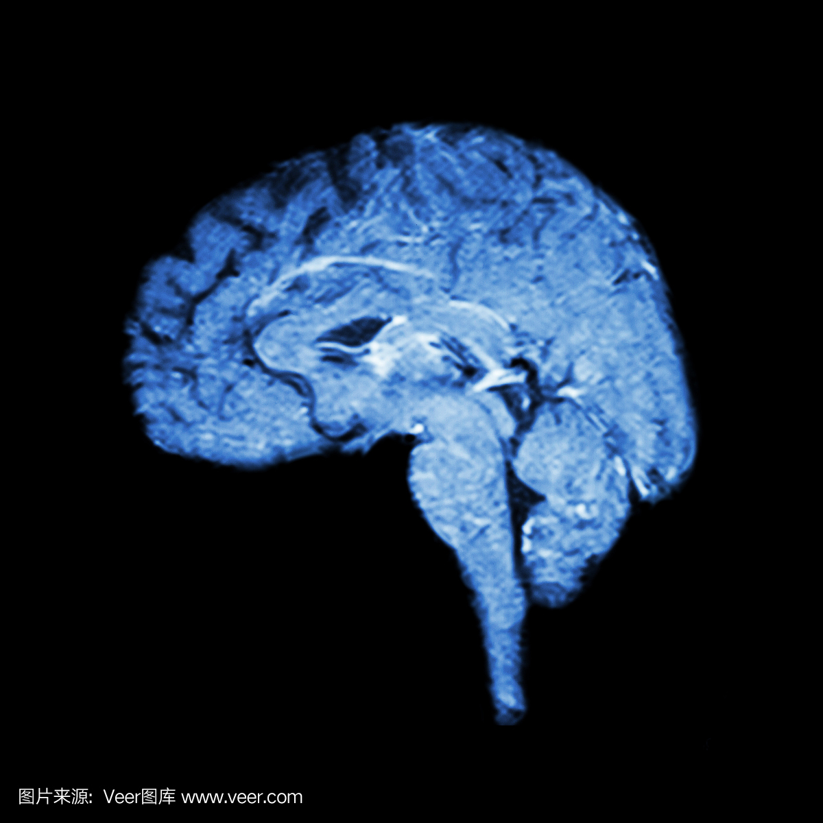 大脑的磁共振成像(MRI)