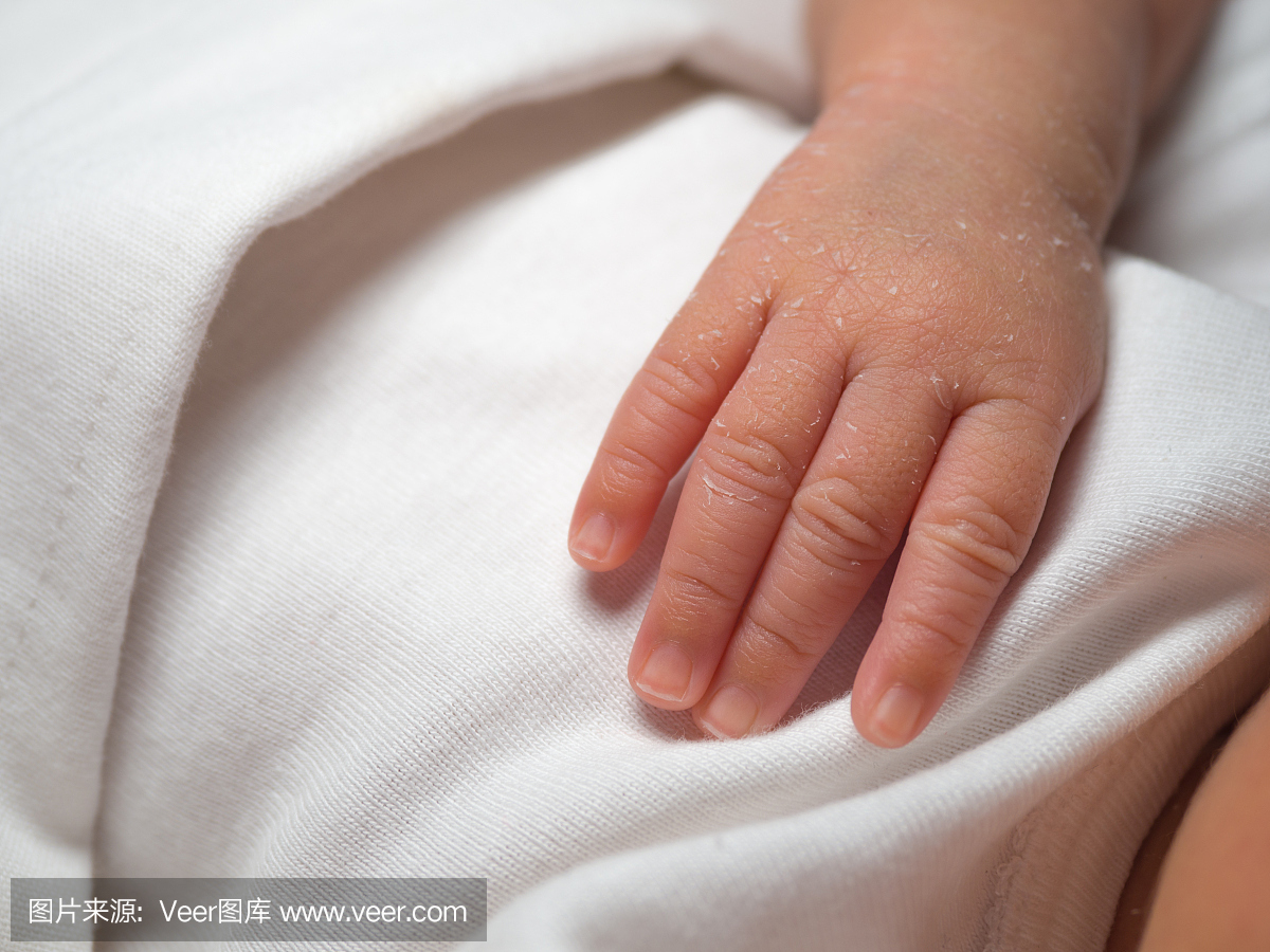 一个新生儿的皮肤在白色布上剥皮的特写手。新
