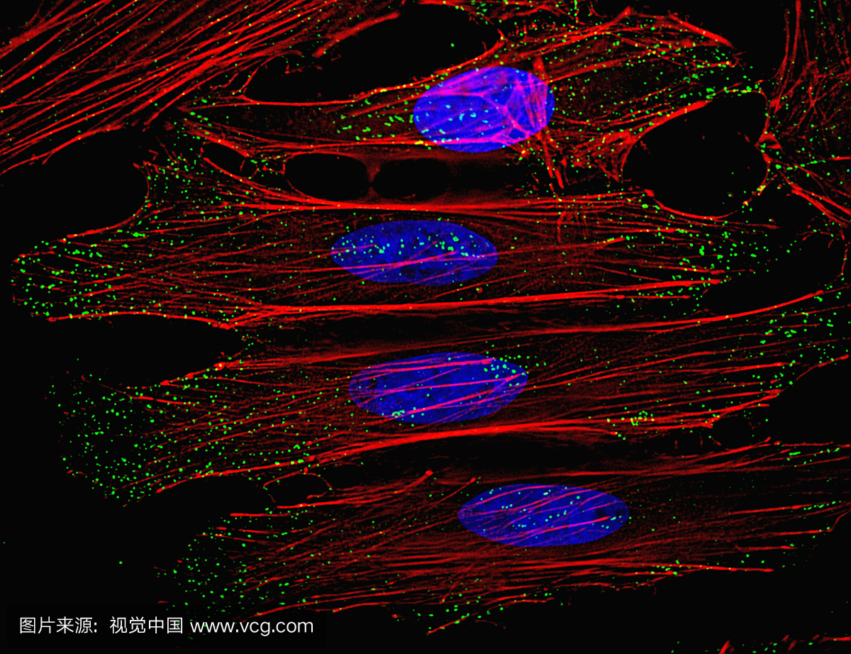 HeLa细胞荧光显微镜(人宫颈腺癌)。 LM X1200(13 x 17英寸)
