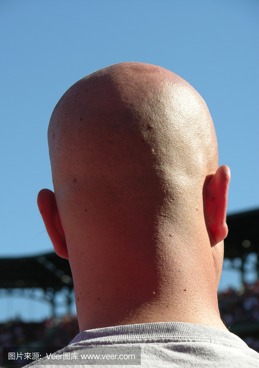 后脑勺,后脑,秃头,没头发