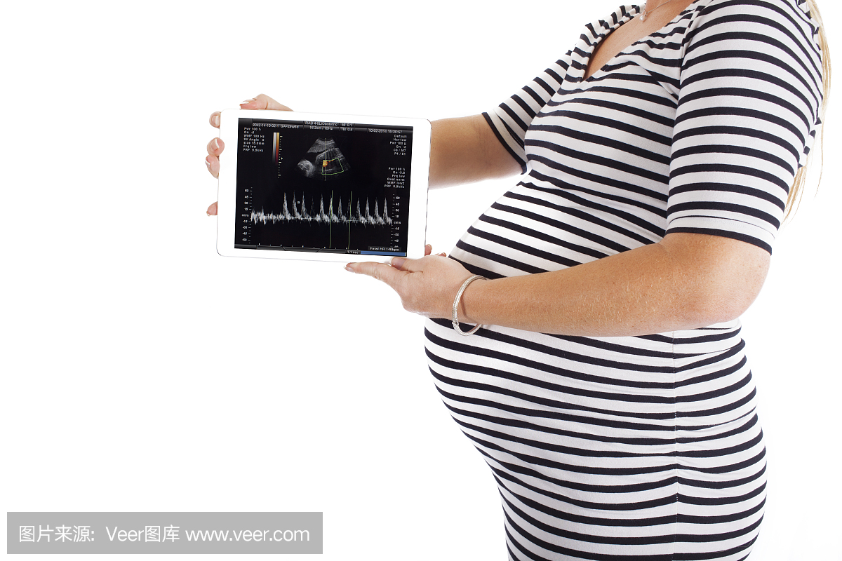 超声胎儿心脏监测