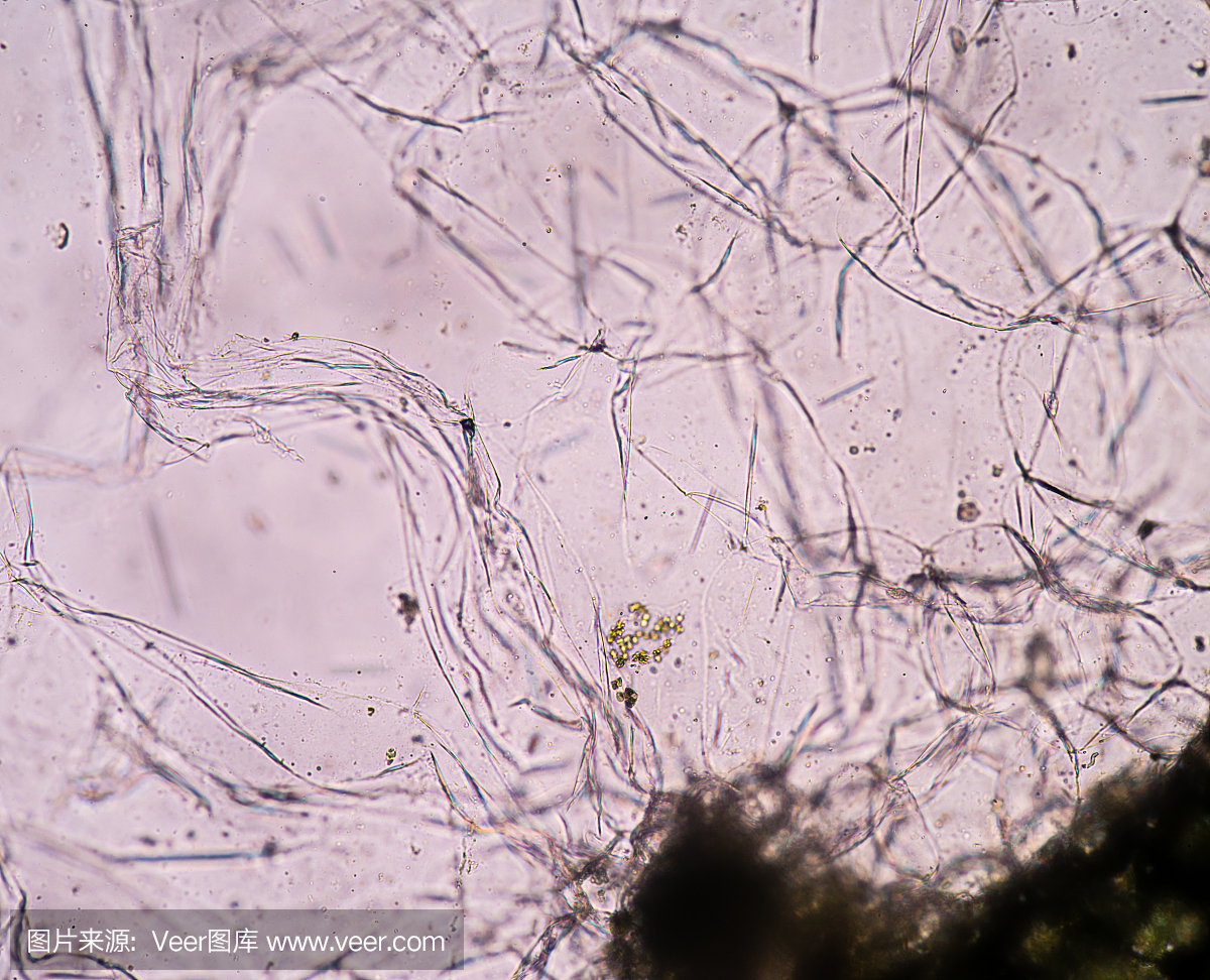 细胞死亡,细胞失活,死细胞,内质网