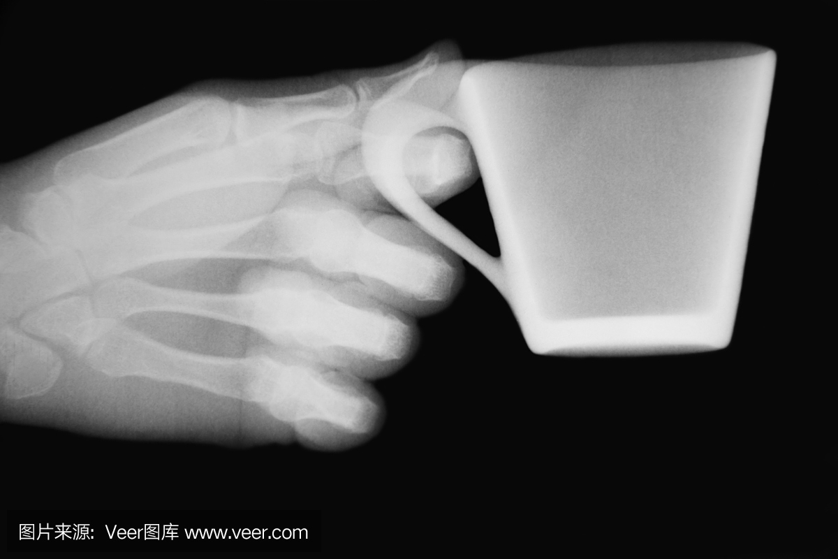 X射线图像用手和杯咖啡XXXL