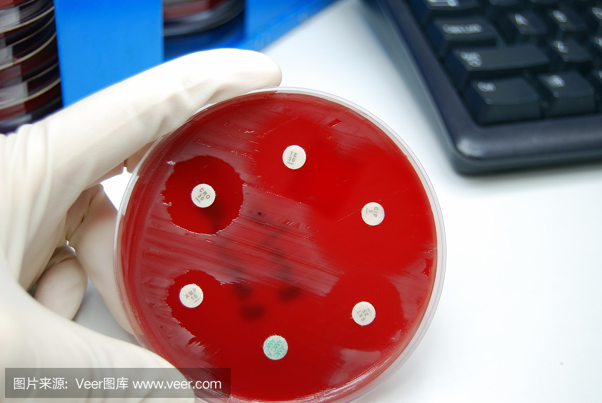 微生物实验室抗生素敏感性检测