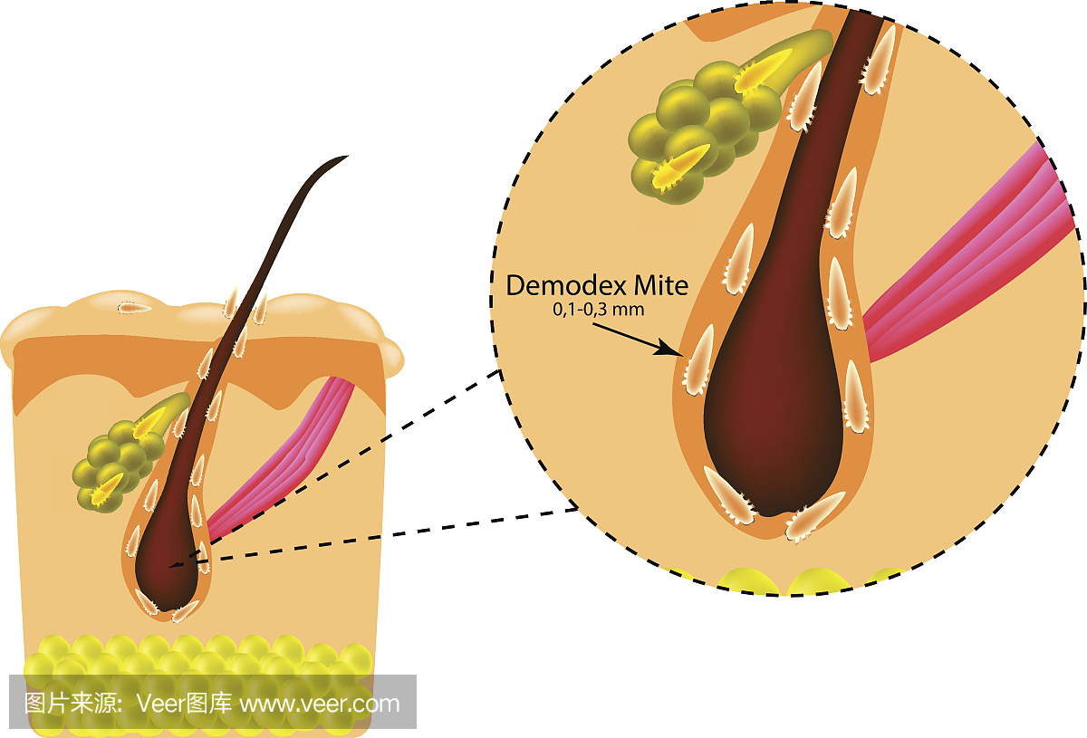 头发的结构。皮脂腺。介绍螨虫。 Demodeco