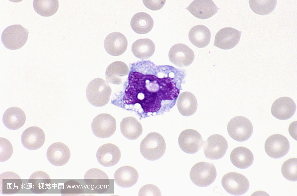 正常人单核细胞白血球与红细胞在外周血涂片的
