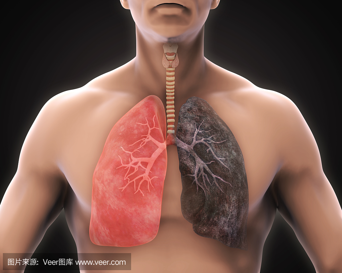 健康肺和吸烟者肺