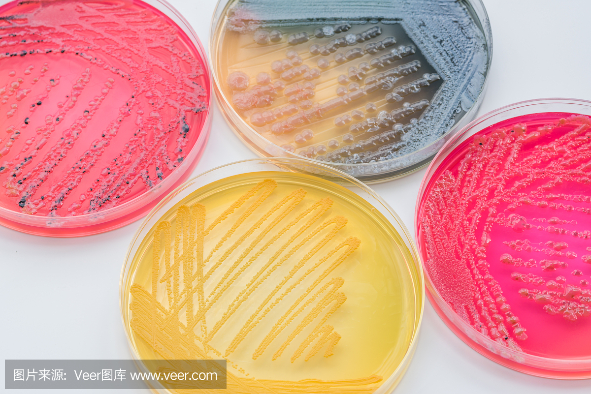 在选择性琼脂培养基上的细菌菌落培养物XLT琼