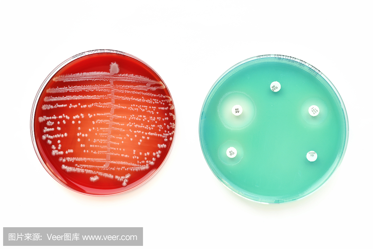 细菌培养和敏感性试验