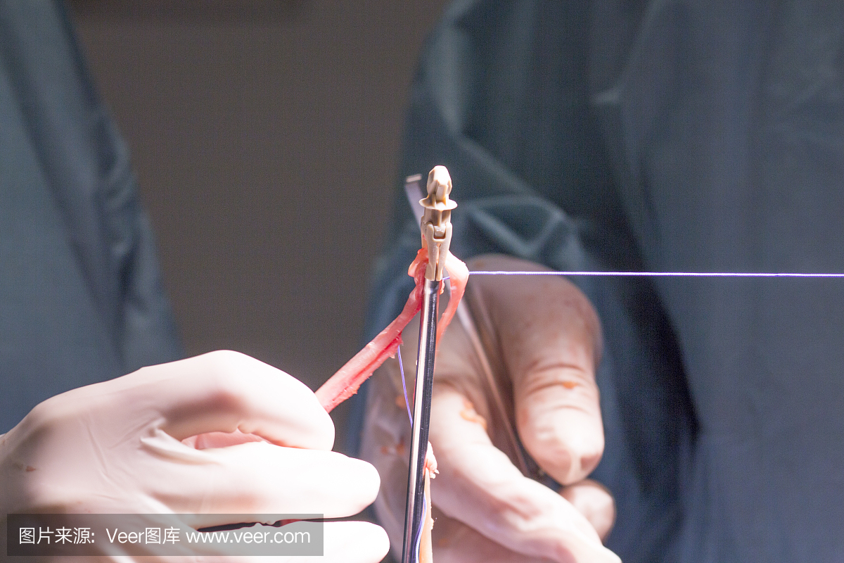 医院手术室急诊室创伤膝关节和骨科膝关节腱和