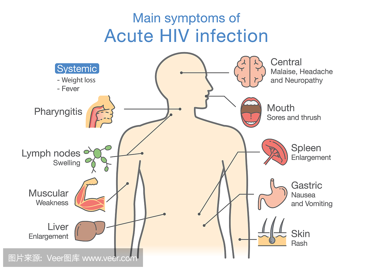 主要症状急性HIV感染。