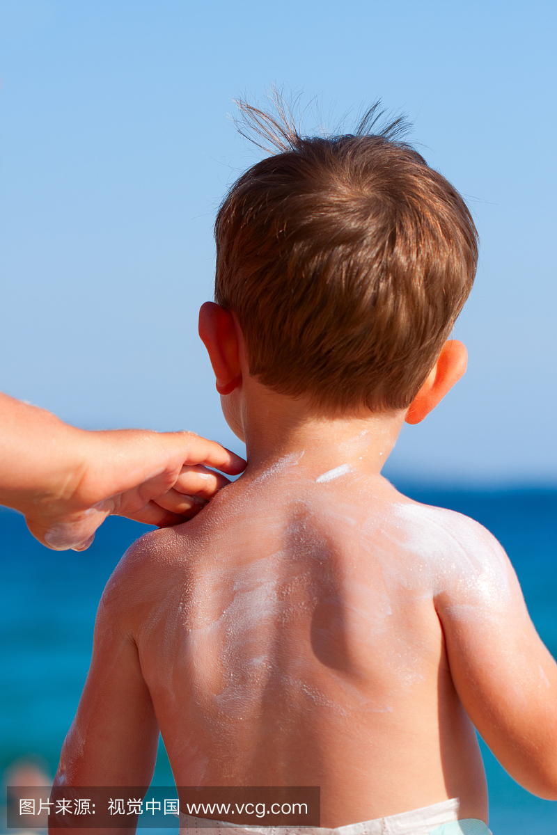 灼伤,起晒斑的,痱子,晒伤