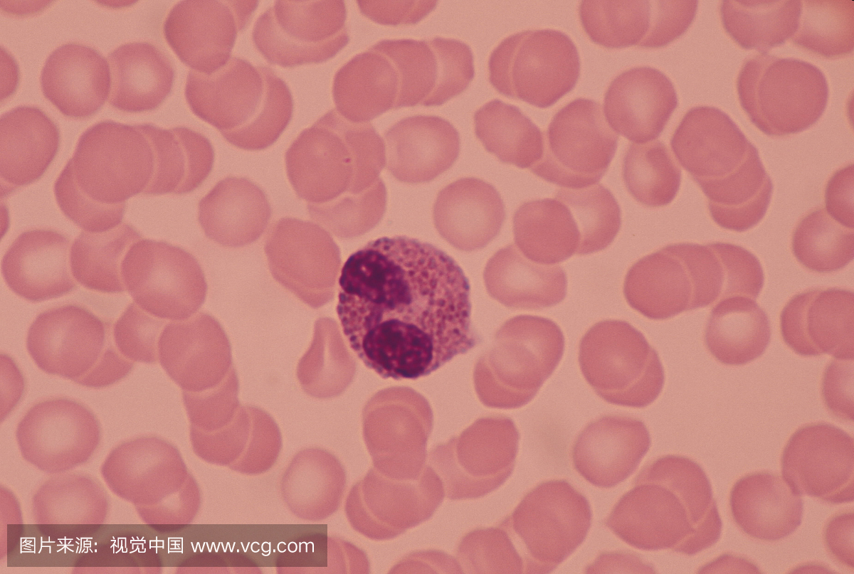 嗜曙红细胞,嗜酸性粒细胞,粒子,细胞核
