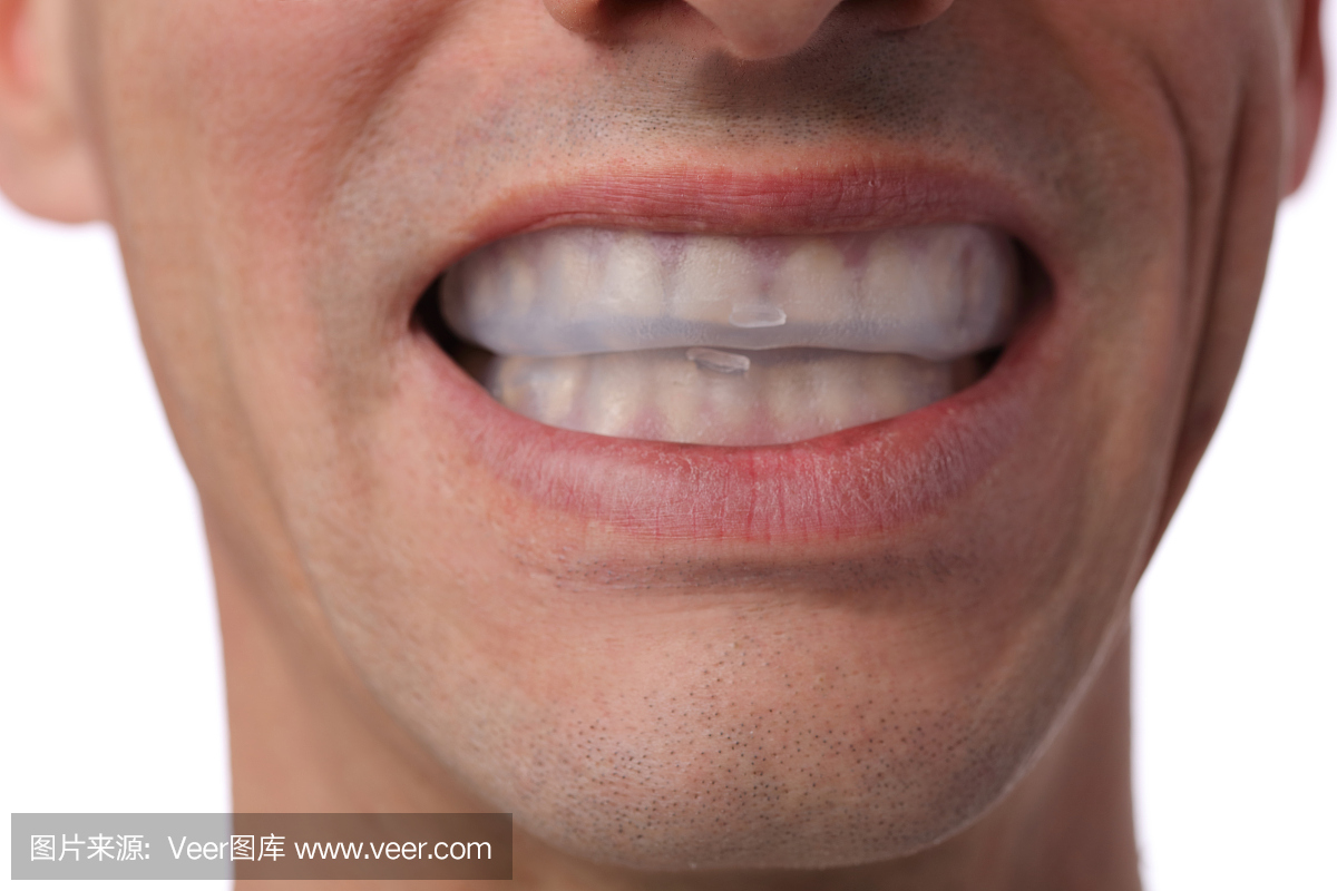 牙齿漂白。人应用美白牙齿牙医凝胶口腔。牙科